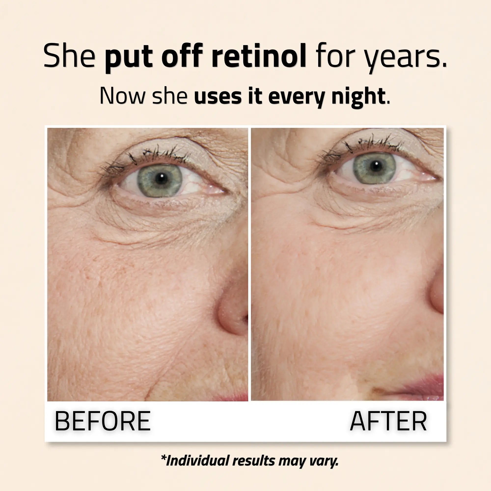 Retinol Serum