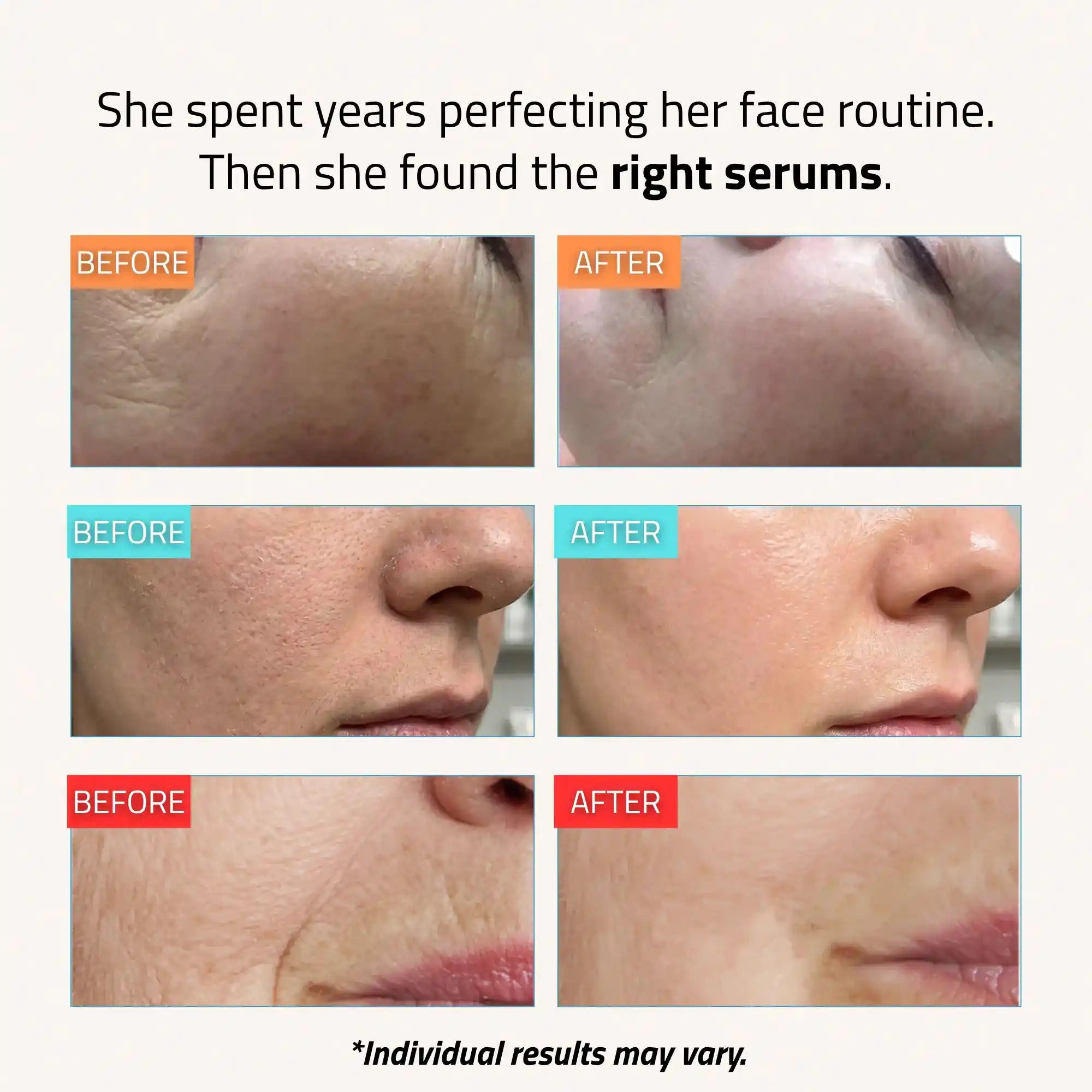 Core Set Serum
