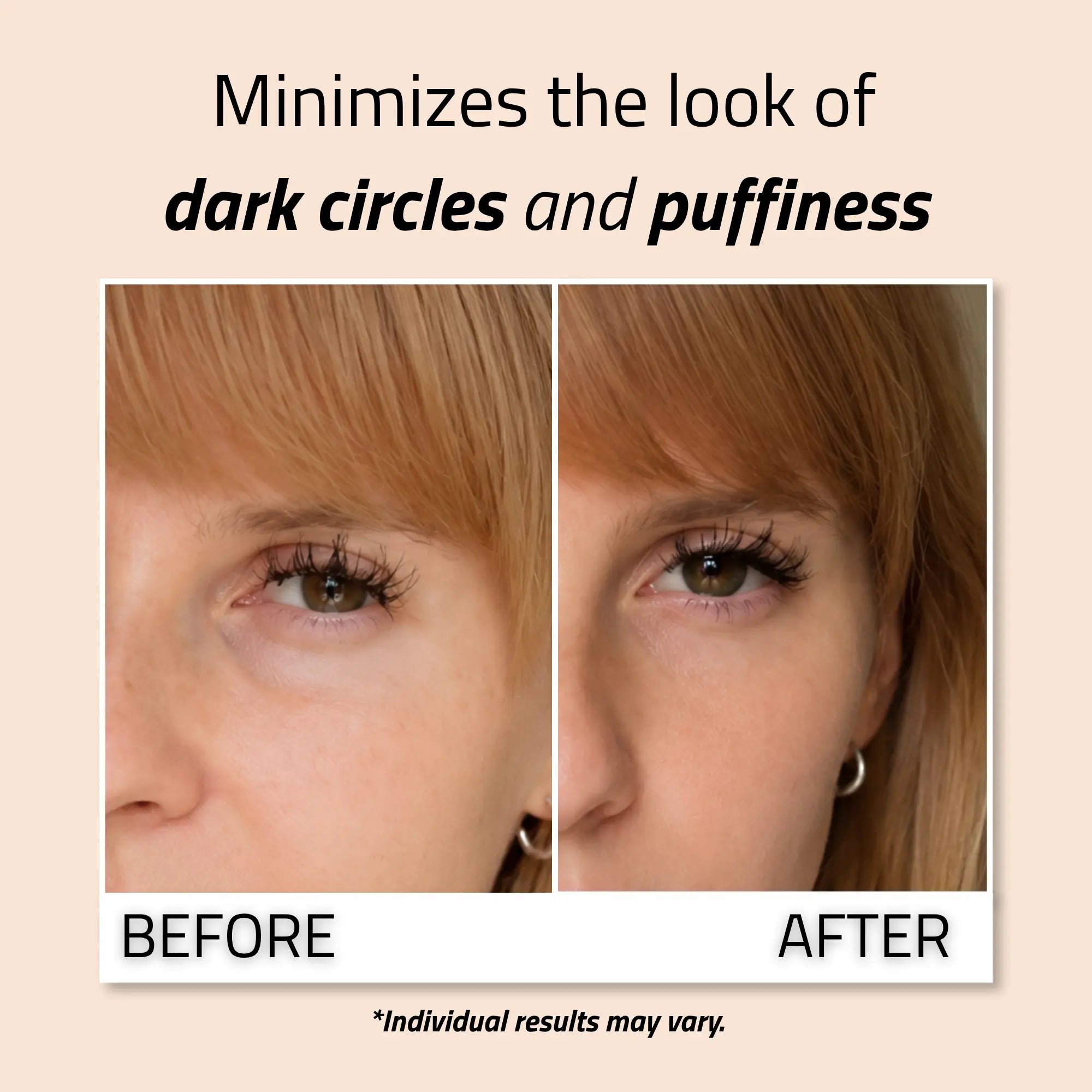 Radiance Eye Gel 1 oz