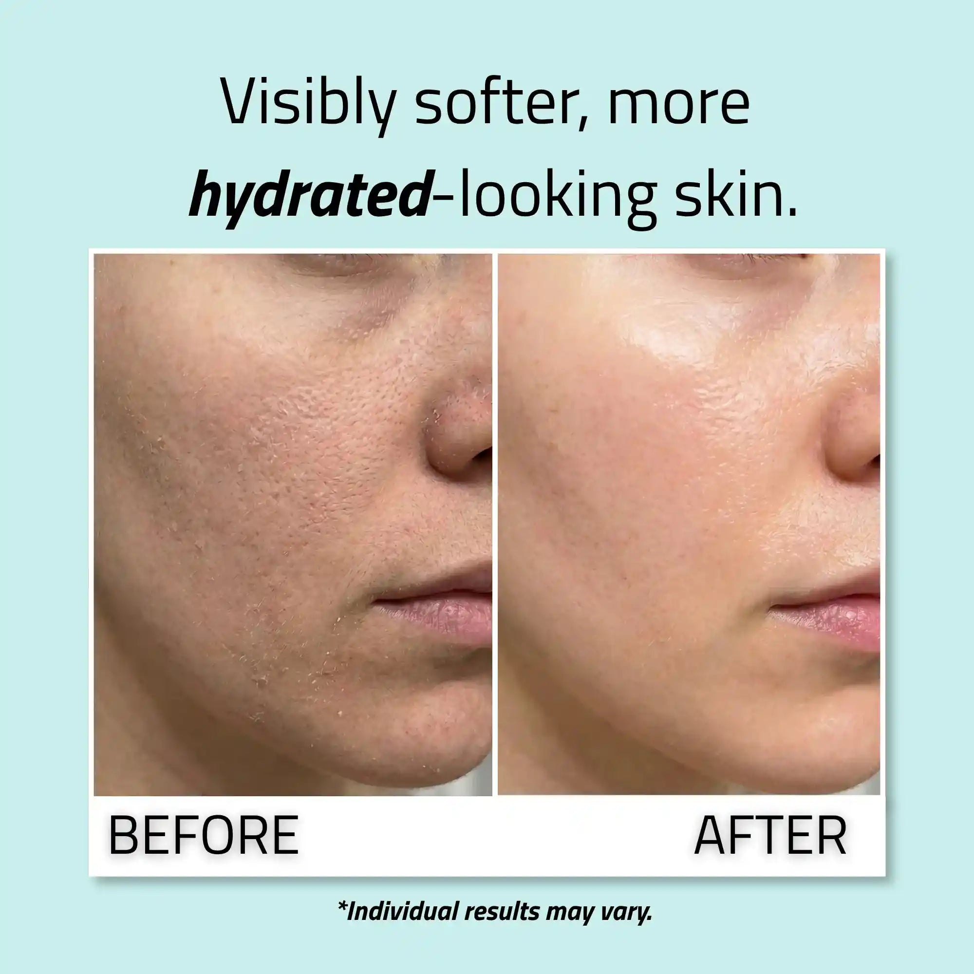 Pure Hyaluronic Acid Serum