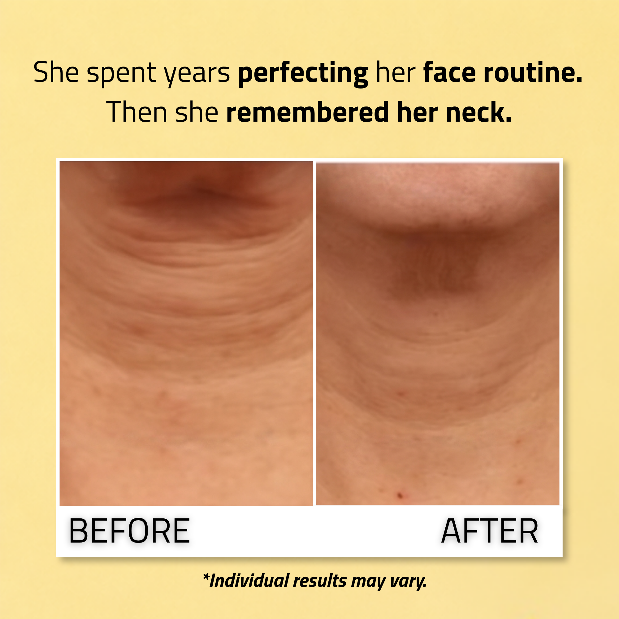 Neck Firming Cream