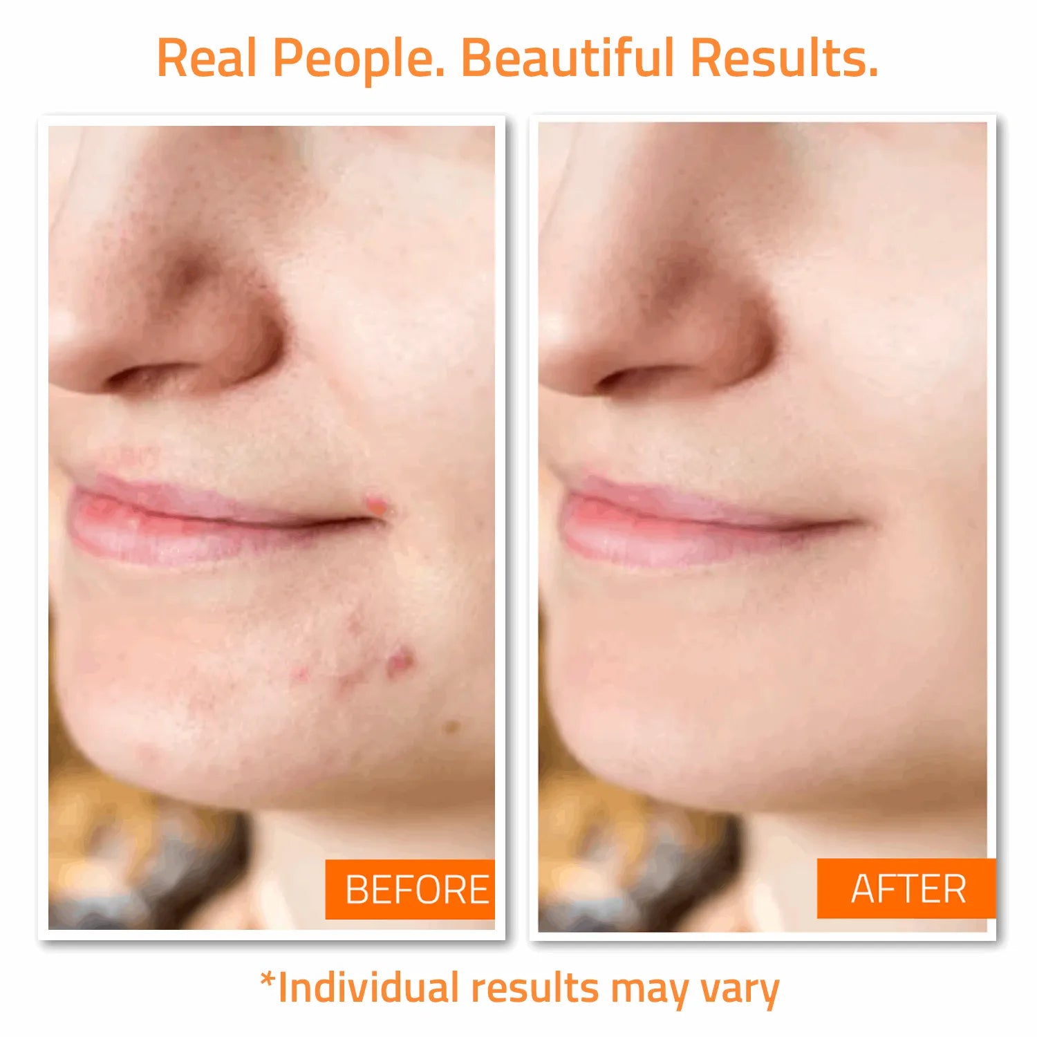 Blemish Defense Set (7 Pack) Blemish Defense Set (7 Pack) Blemish Defense Set (7 Pack)