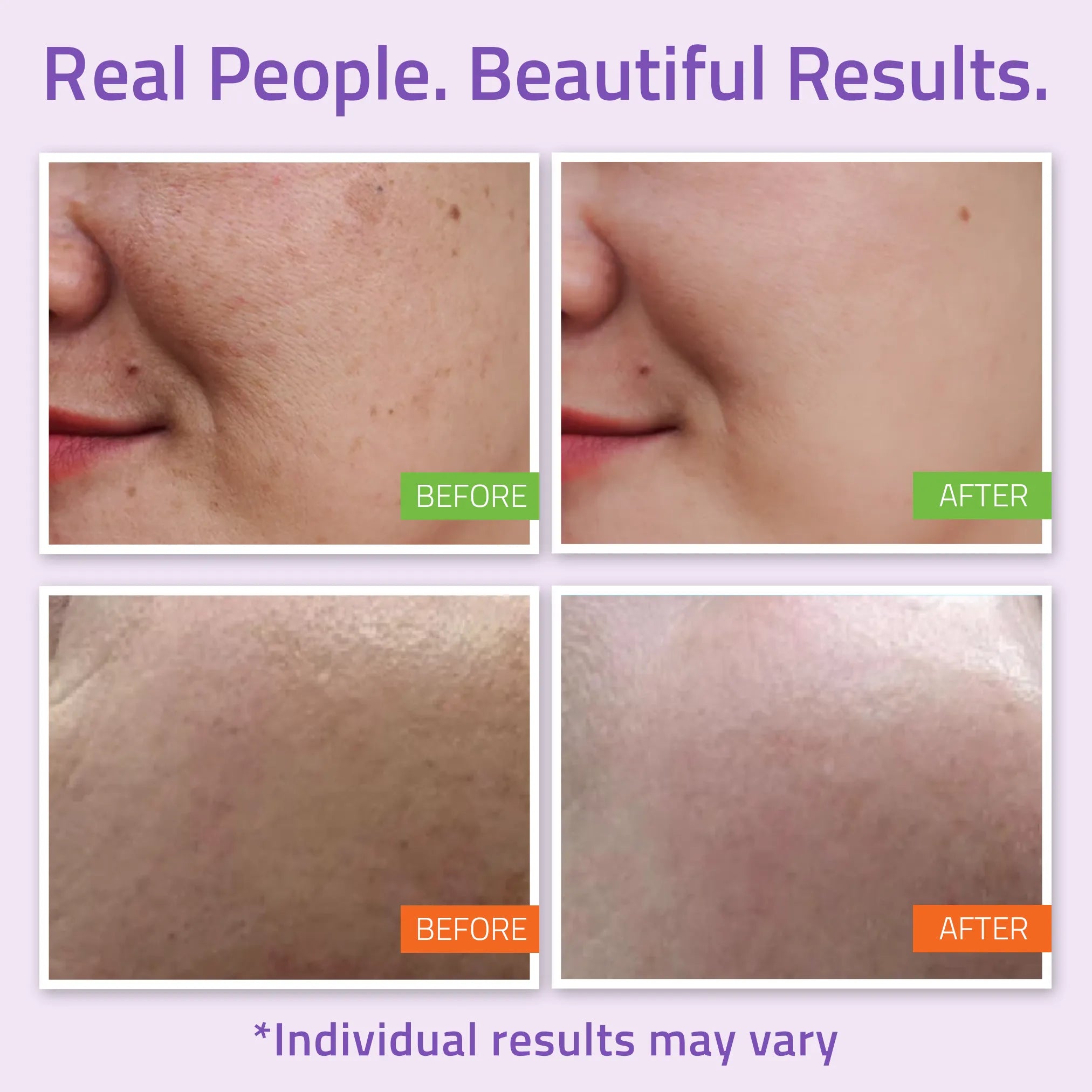 Hydrate & Nourish Skincare Essentials Plus Set (5 Pack) Hydrate & Nourish Skincare Essentials Plus Set (5 Pack)