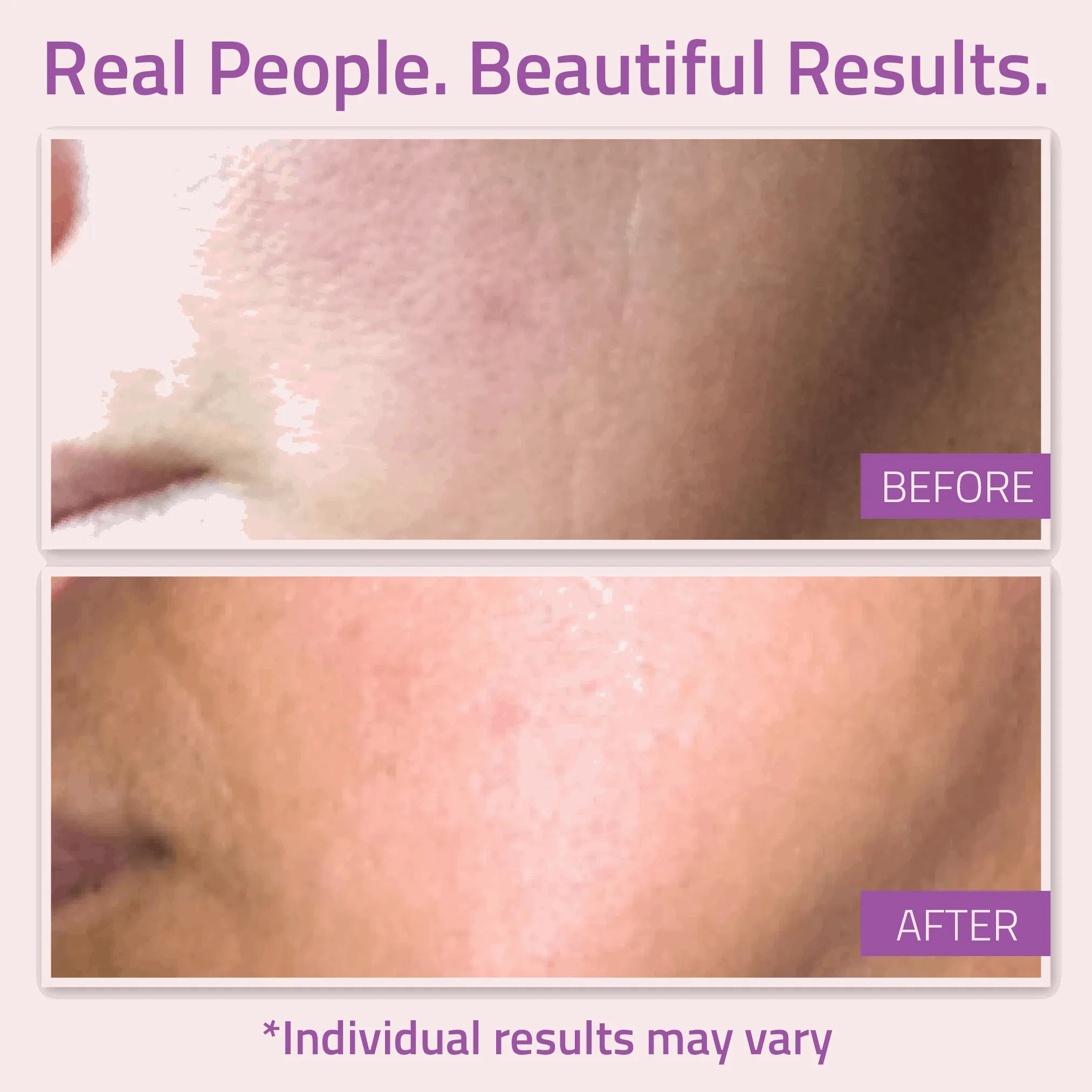 Close-up before and after images showing smoother, more even-looking skin after using YEOUTH glow serum.