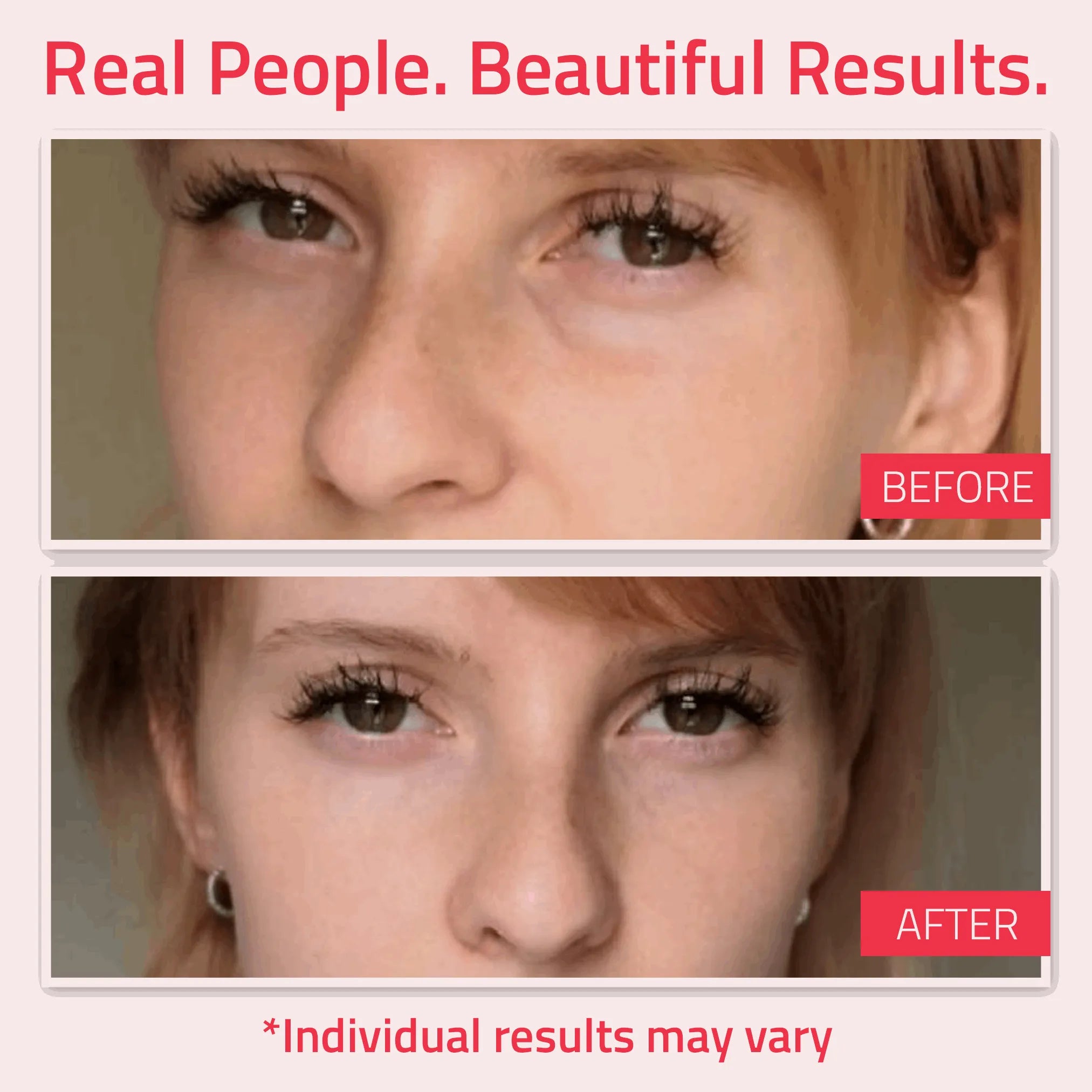 Before and after eye area results from YEOUTH skincare, showing reduced visible puffiness and smoother under eye appearance.