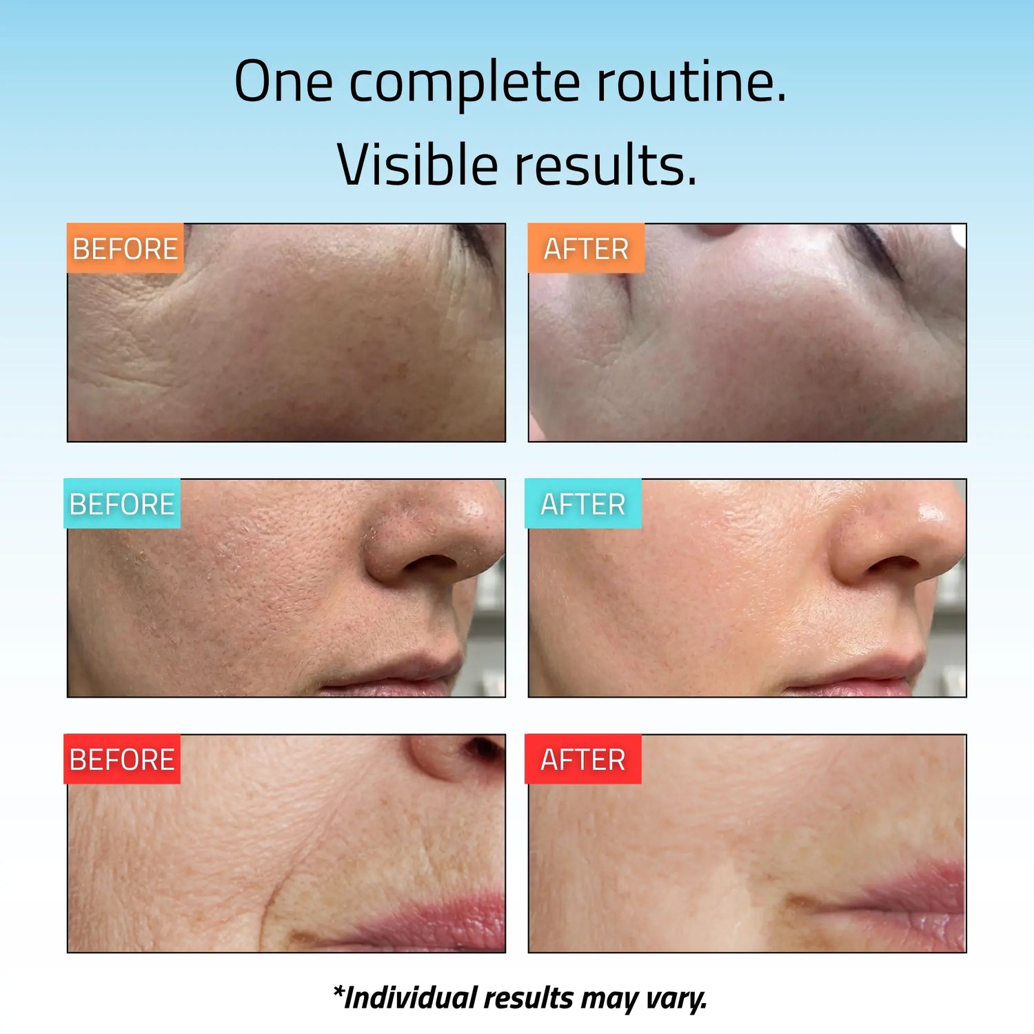 Complete Skincare Essentials Set (8 Pack)