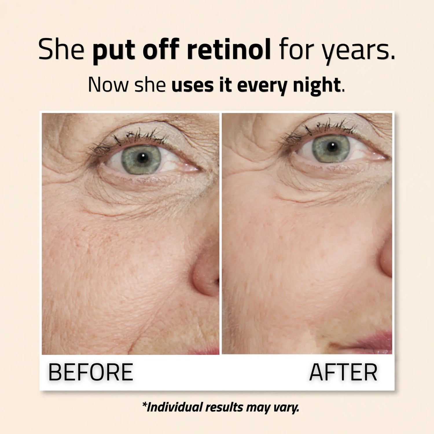 Retinol Serum