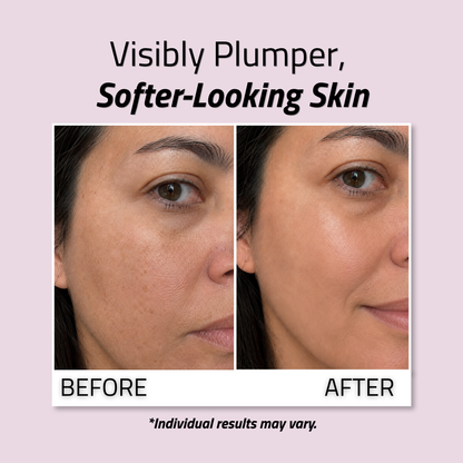 Hyaluronic Acid Cream 1 oz