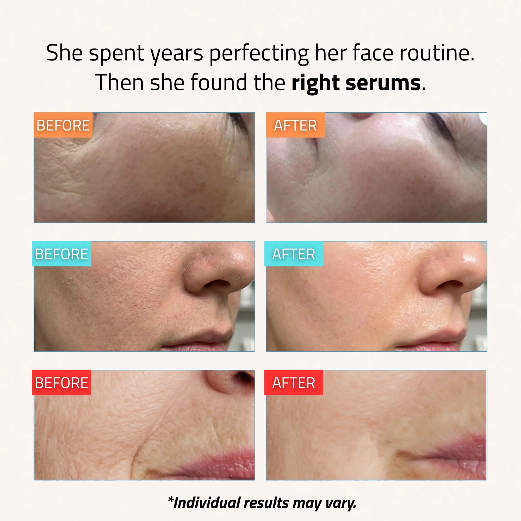 Core Set Serum