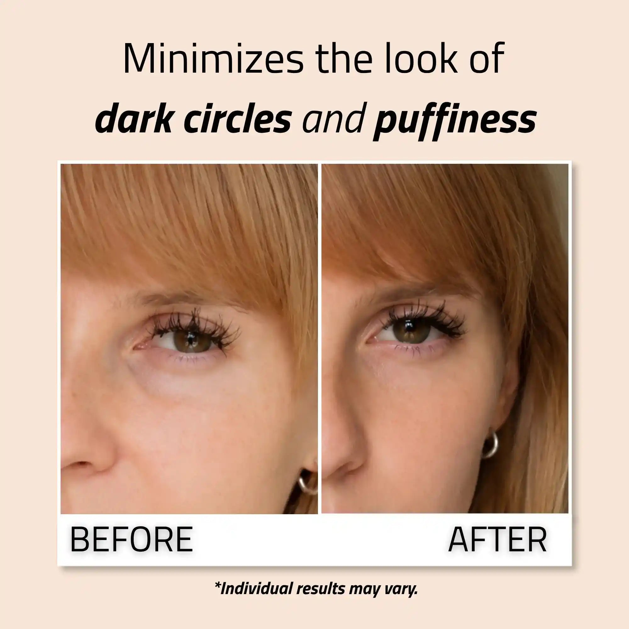 Radiance Eye Gel 1 oz
