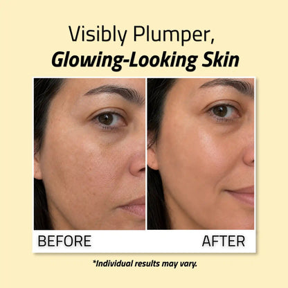 Niacinamide Serum