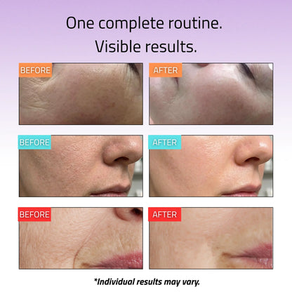 Advanced Skincare Essentials Set (6 Pack)