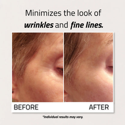 Retinol Eye Cream 15ml