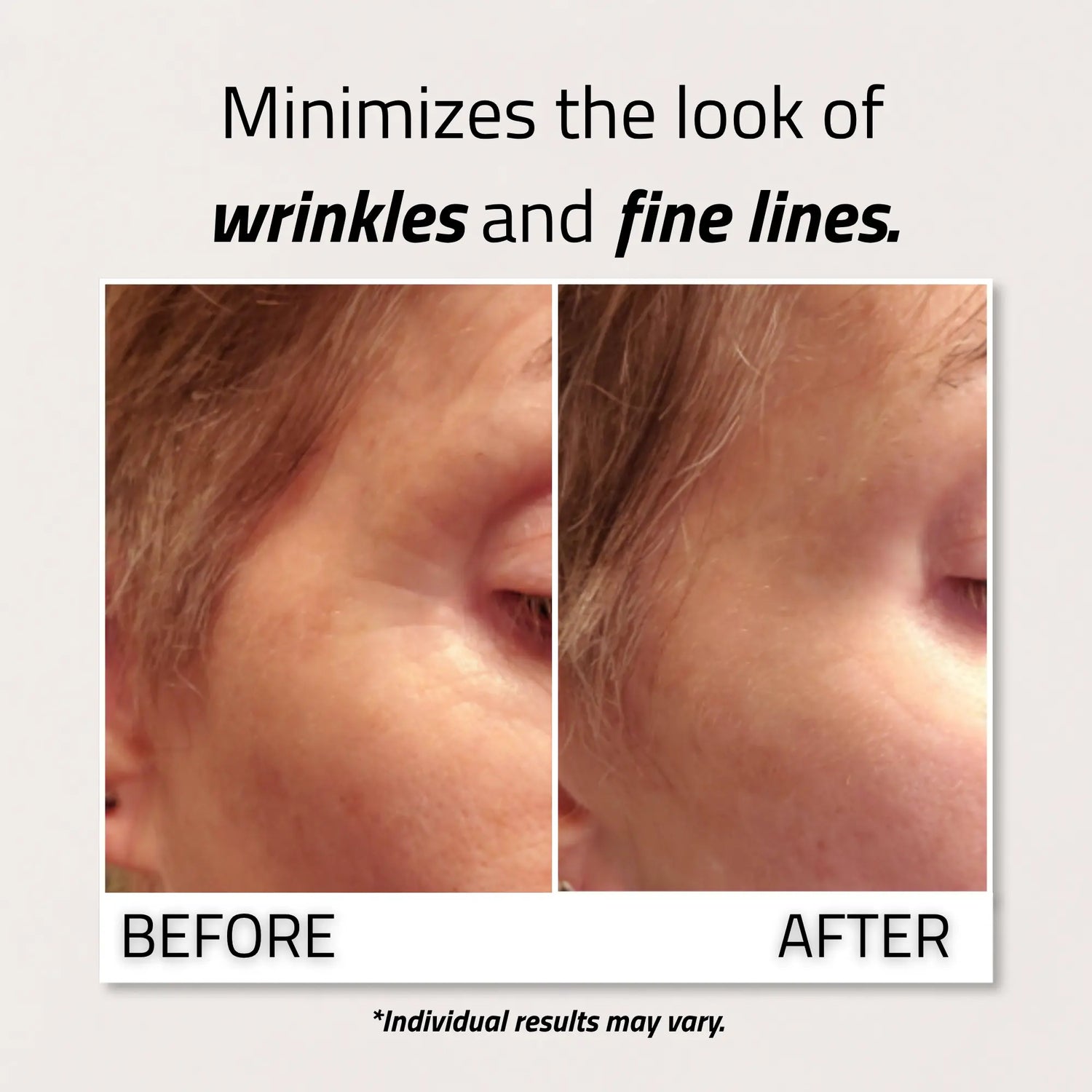 Retinol Eye Cream