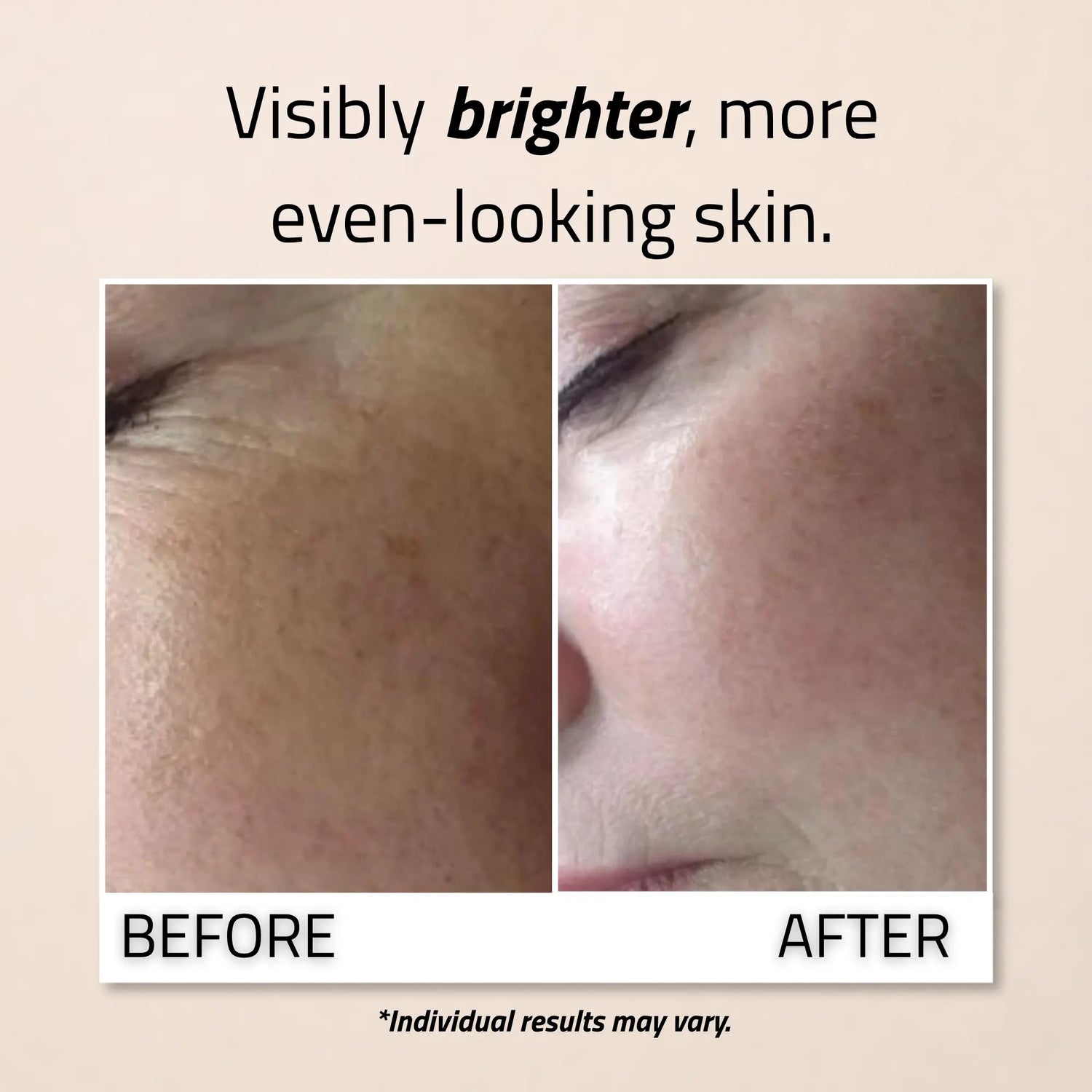 Vitamin C &amp; E Serum