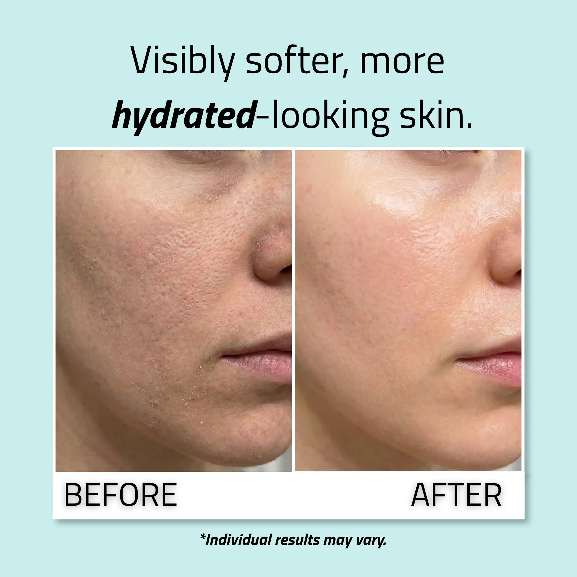 Pure Hyaluronic Acid Serum