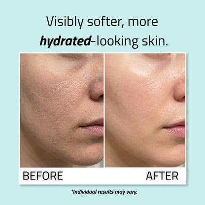 Pure Hyaluronic Acid Serum