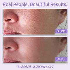 Balancing Facial Toner 3.4 oz Balancing Facial Toner 3.4 oz