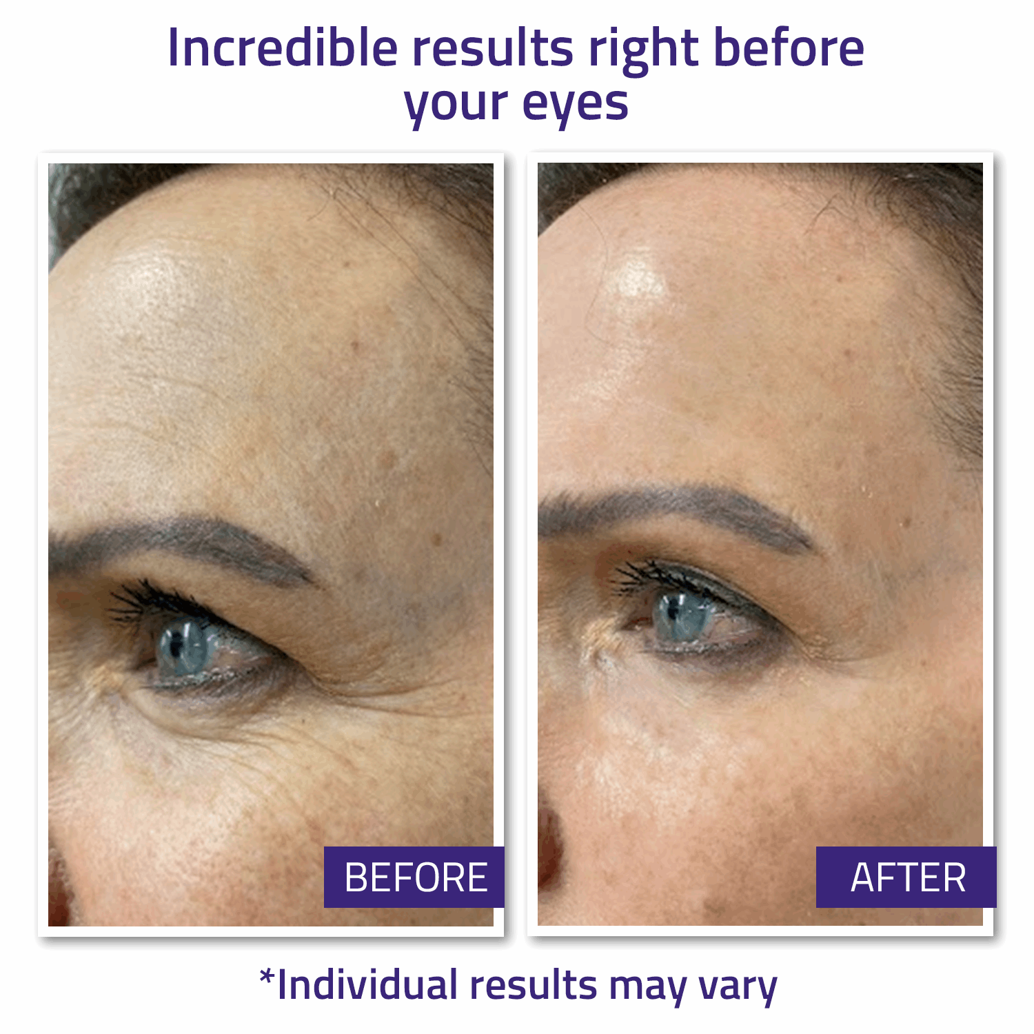 Instant Face Lift Cream 15ml Instant Face Lift Cream 15ml