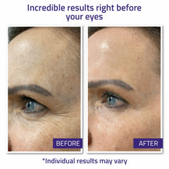 Instant Face Lift Cream 15ml Instant Face Lift Cream 15ml Instant Face Lift Cream 15ml