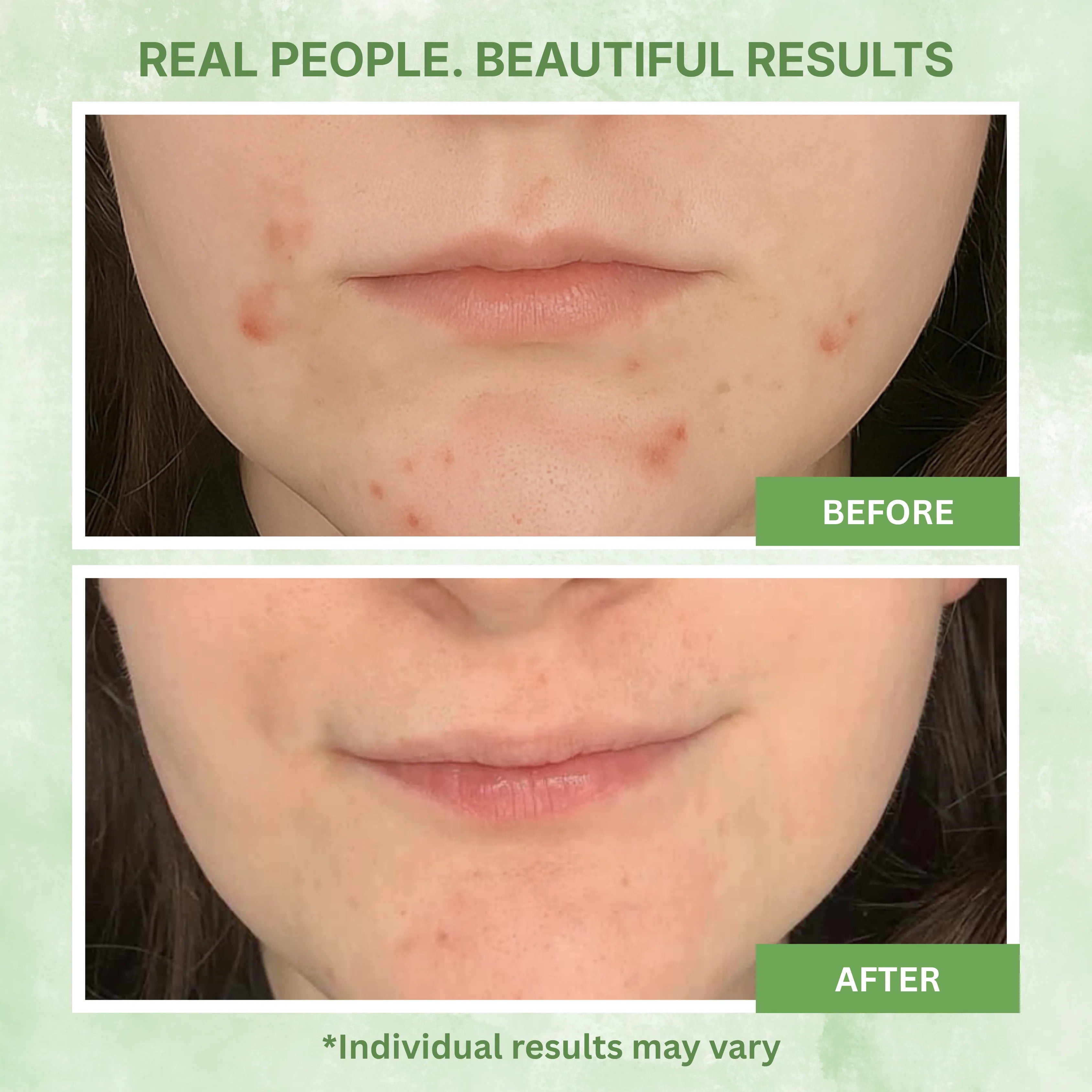 Glycolic Acid Gel Peel 30% 