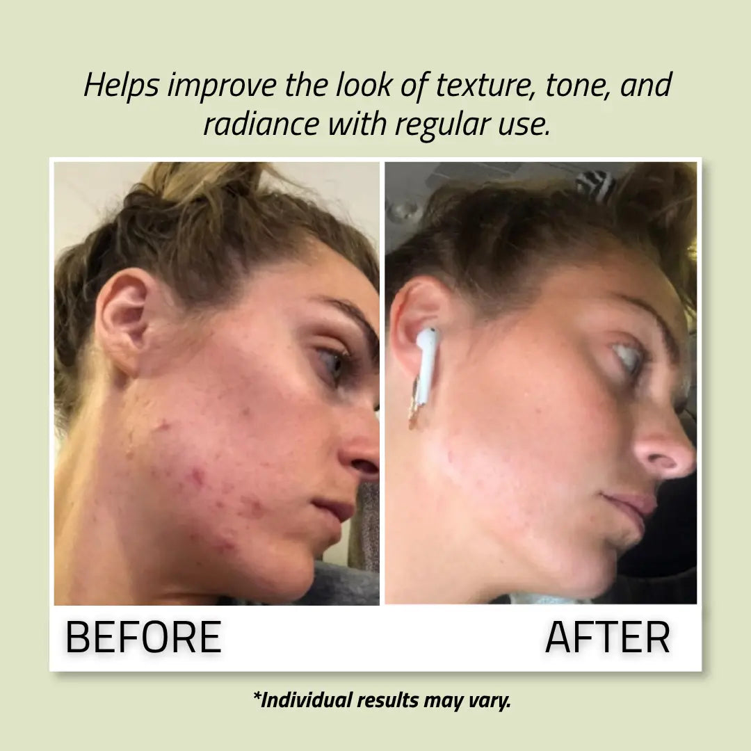 Glycolic Acid Pads