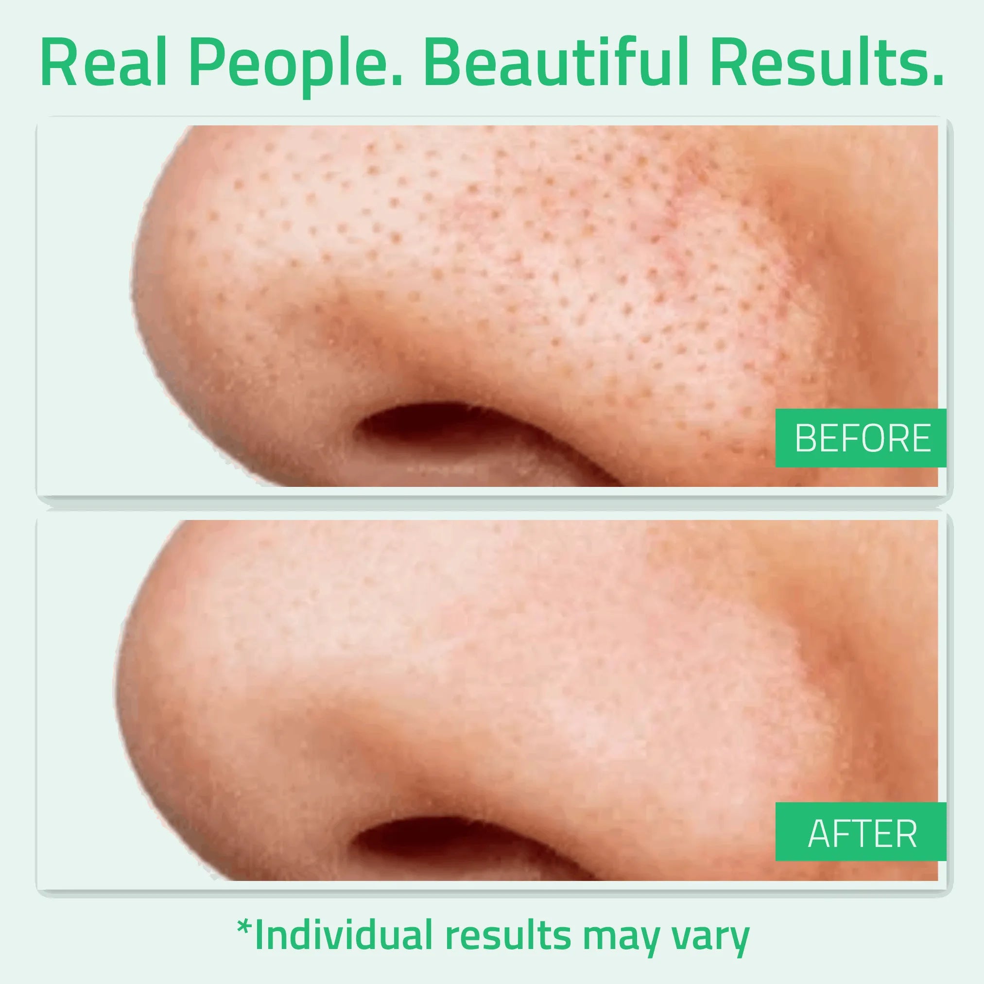 Glycolic Acid Toner 6 oz Glycolic Acid Toner 6 oz Glycolic Acid Toner 6 oz