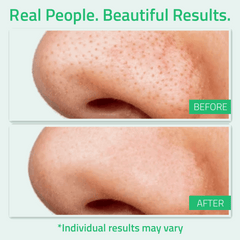 Glycolic Acid Toner 6 oz Glycolic Acid Toner 6 oz