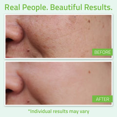 Hyaluronic Acid Plus Serum Hyaluronic Acid Plus Serum