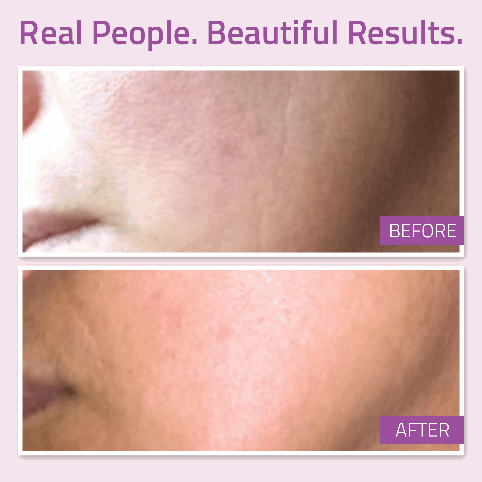 AM / PM Serum Bundle: Anti-Aging Super Serum 1 oz & Retinol Serum 1 oz AM / PM Serum Bundle: Anti-Aging Super Serum 1 oz & Retinol Serum 1 oz