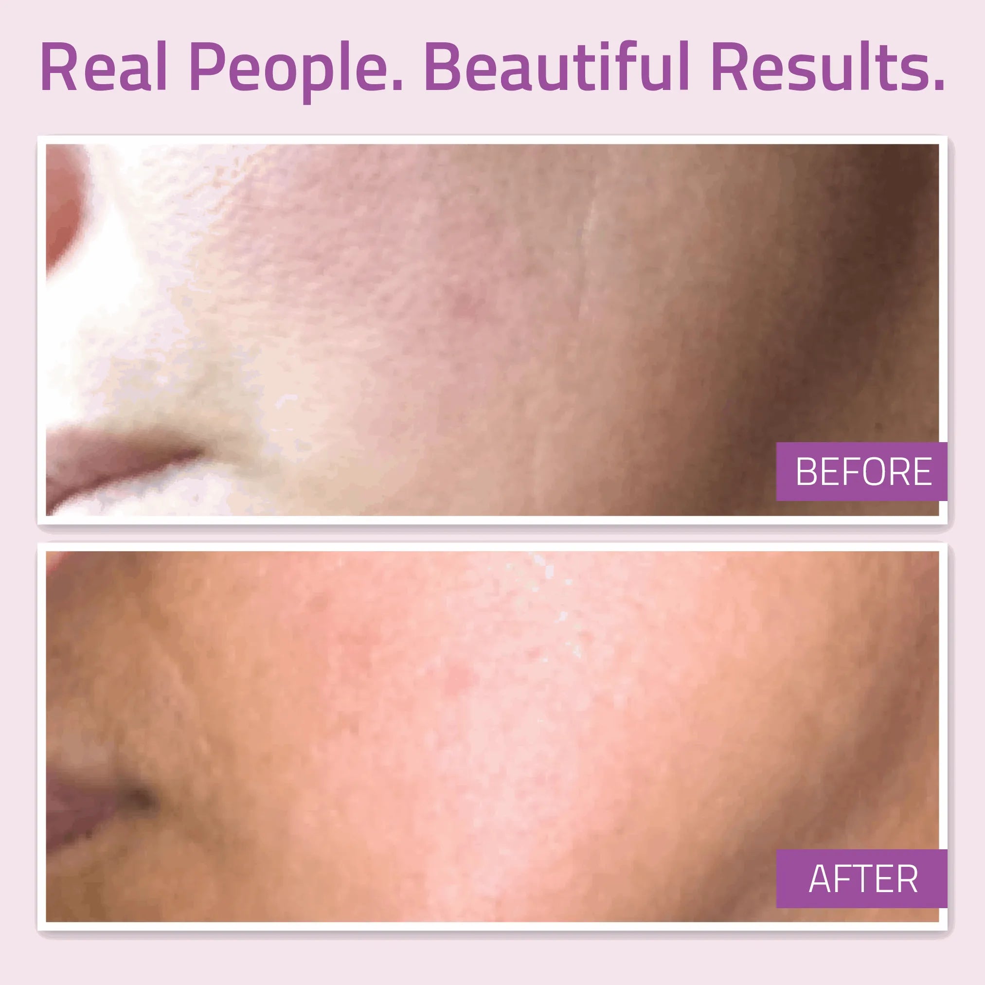 AM / PM Serum Bundle: Anti-Aging Super Serum 1 oz &amp; Retinol Serum 1 oz AM / PM Serum Bundle: Anti-Aging Super Serum 1 oz &amp; Retinol Serum 1 oz AM / PM Serum Bundle: Anti-Aging Super Serum 1 oz &amp; Retinol Serum 1 oz