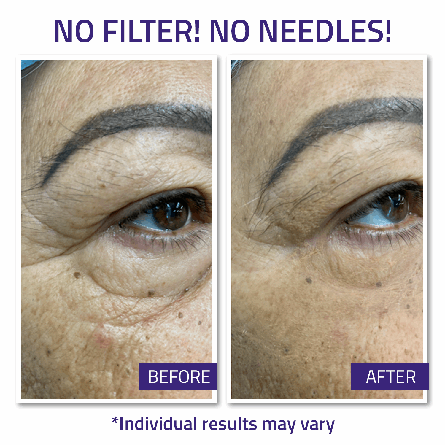 Instant Face Lift Cream 15ml