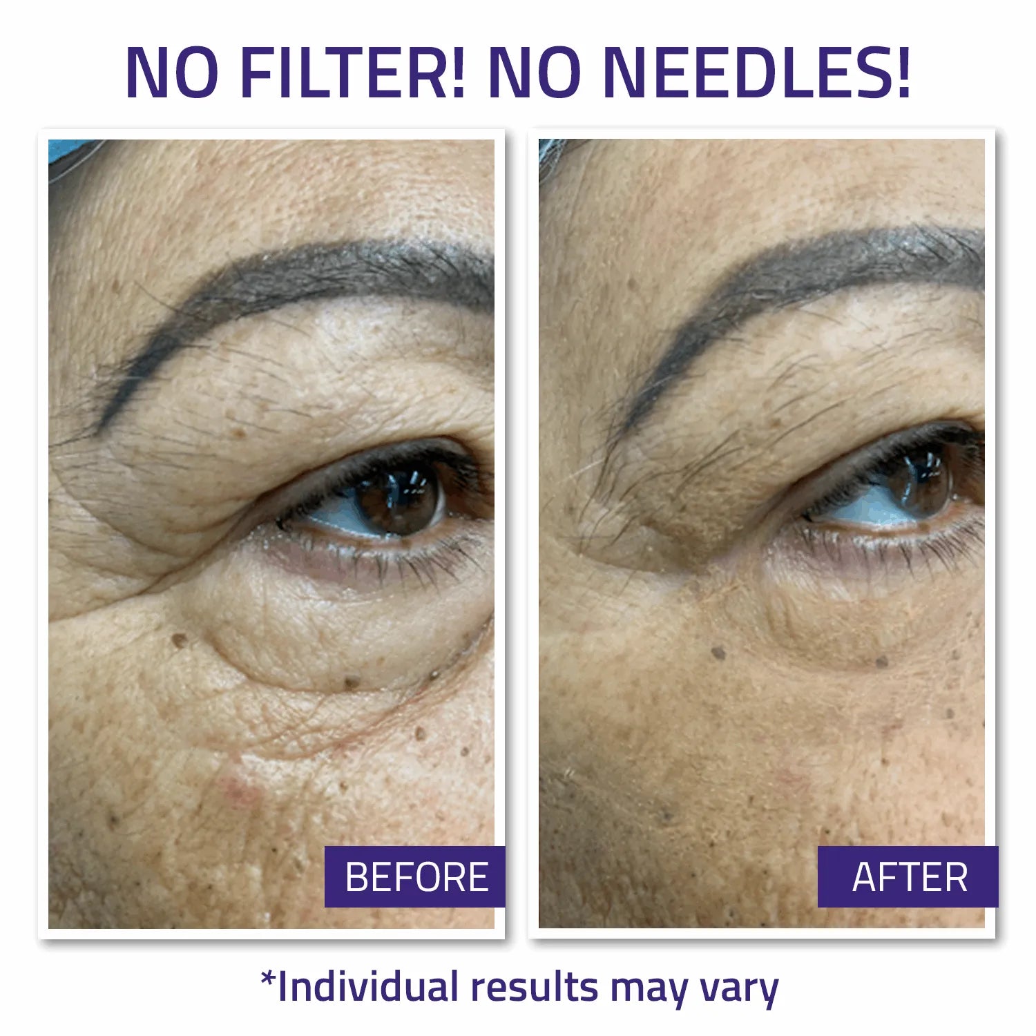 Instant Face Lift Cream 15ml Instant Face Lift Cream 15ml Instant Face Lift Cream 15ml