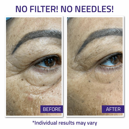 Instant Face Lift Cream 15ml Instant Face Lift Cream 15ml Instant Face Lift Cream 15ml