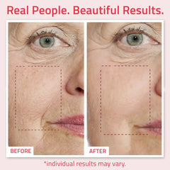 Before and after comparison showing smoother-looking skin after using resurfacing retinol serum
skincare product. 
