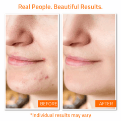 Blemish Defense Set (7 Pack) Blemish Defense Set (7 Pack)