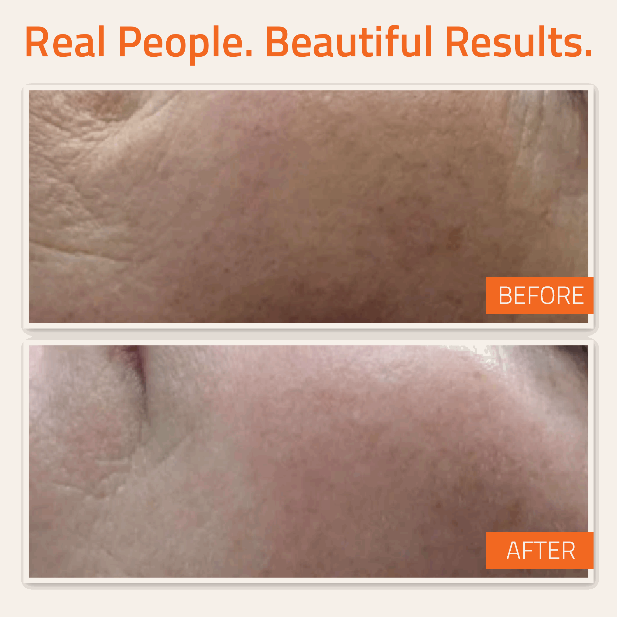 Vitamin C&E Serum 1 oz & Hyaluronic Acid Plus 1 oz Vitamin C&E Serum 1 oz & Hyaluronic Acid Plus 1 oz