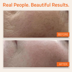 Vitamin C&E Serum 1 oz & Hyaluronic Acid Plus 1 oz Vitamin C&E Serum 1 oz & Hyaluronic Acid Plus 1 oz Vitamin C&E Serum 1 oz & Hyaluronic Acid Plus 1 oz