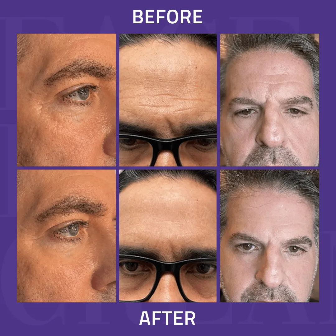 Instant Face Lift Cream 15ml Instant Face Lift Cream 15ml Instant Face Lift Cream 15ml