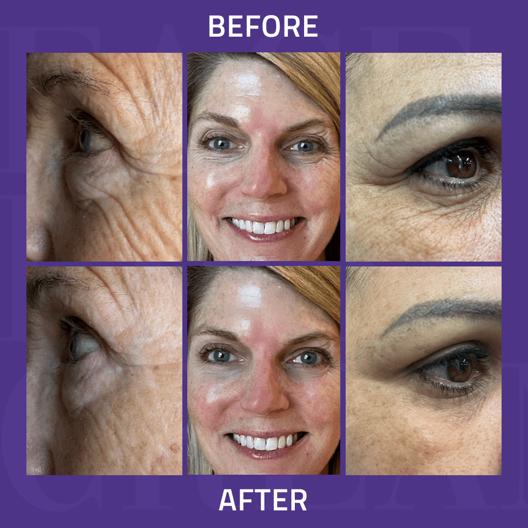 Instant Face Lift Cream 15ml Instant Face Lift Cream 15ml