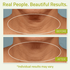 Neck Firming Cream with Green Tea and Vitamin C