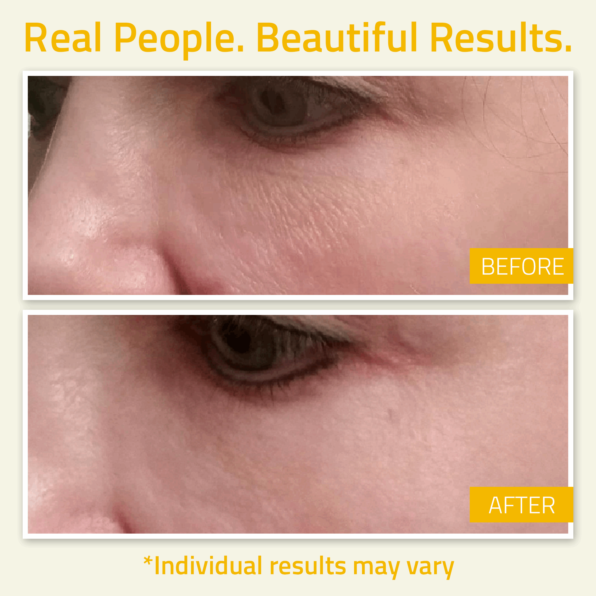 Niacinamide Serum Niacinamide Serum