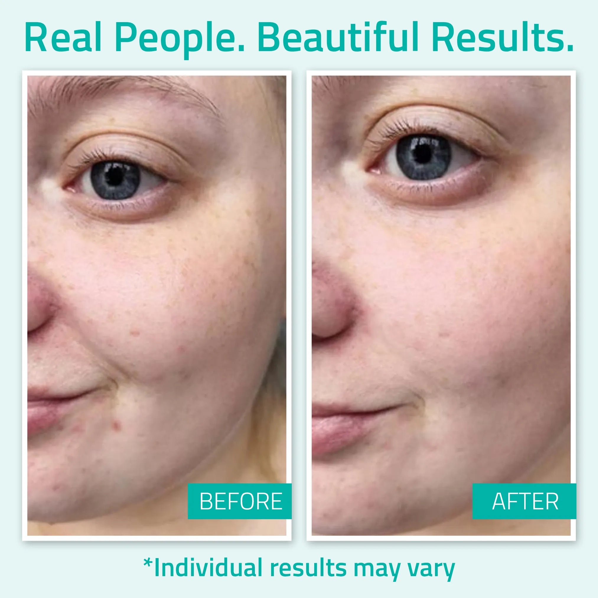 Pure Hyaluronic Acid Serum Pure Hyaluronic Acid Serum