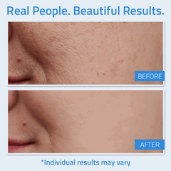 Regenotin Advanced Collagen Generator Regenotin Advanced Collagen Generator