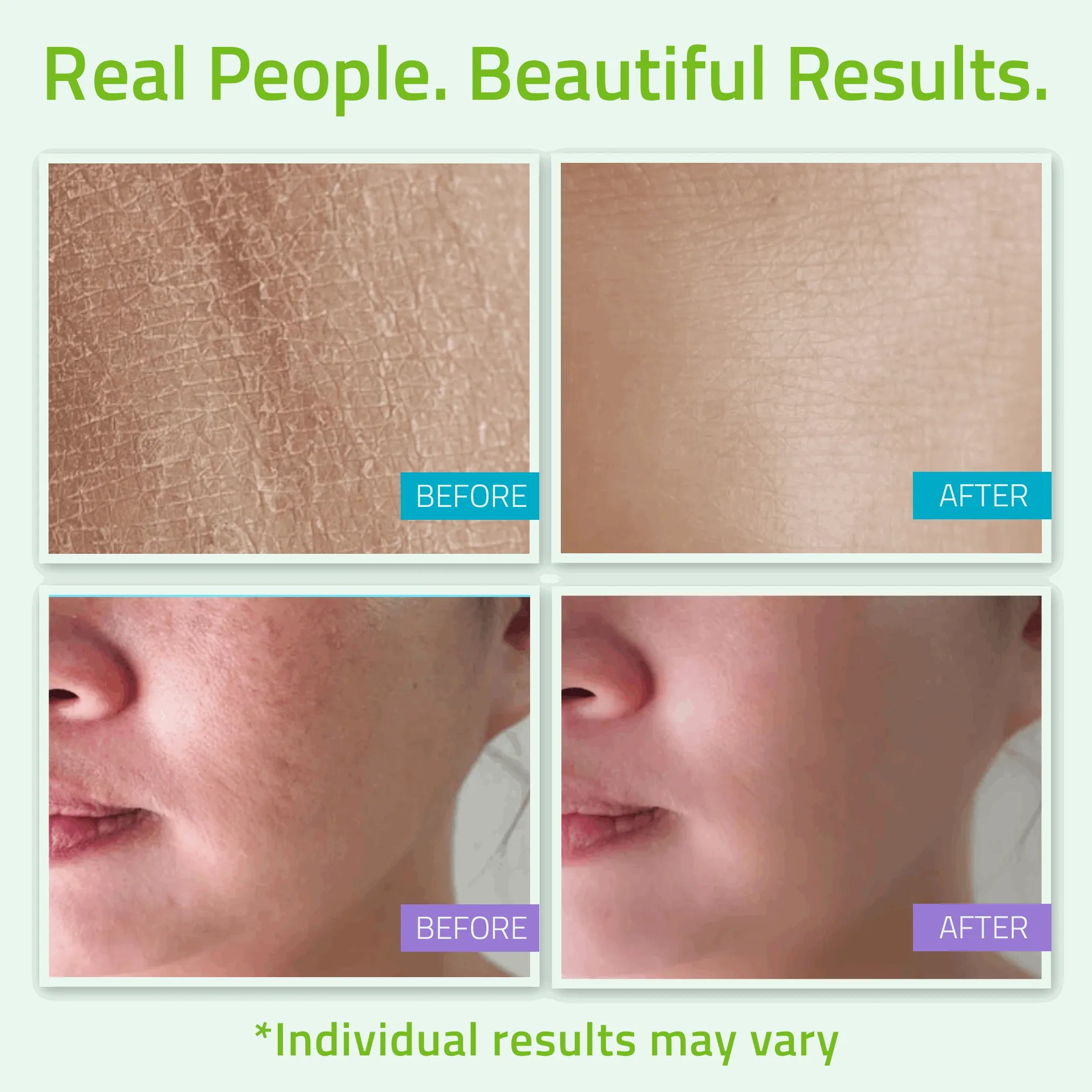 Teen Skincare Set (4 Pack) Teen Skincare Set (4 Pack) Teen Skincare Set (4 Pack)