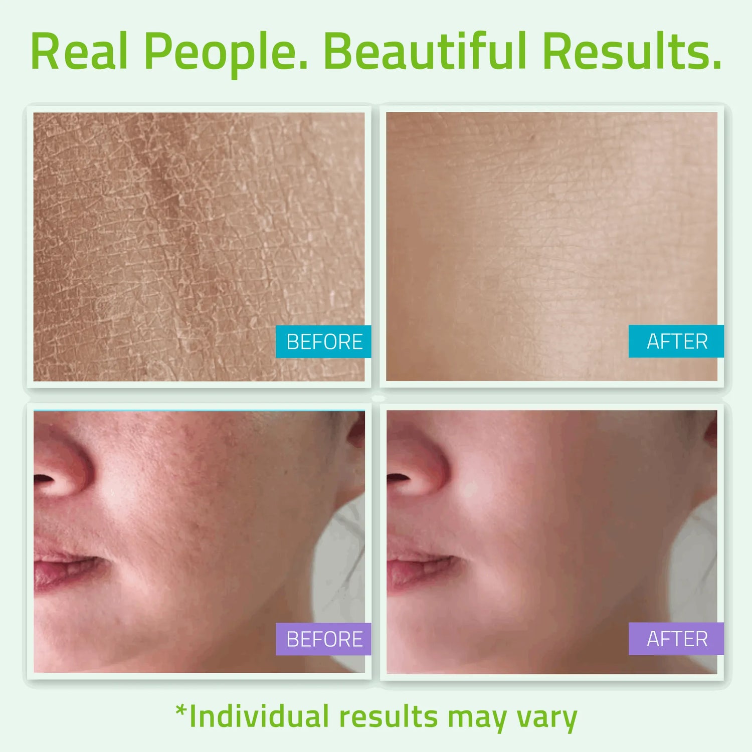 Teen Skincare Set (4 Pack) Teen Skincare Set (4 Pack) Teen Skincare Set (4 Pack)