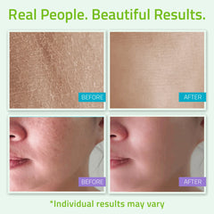 Teen Skincare Set (4 Pack) Teen Skincare Set (4 Pack) Teen Skincare Set (4 Pack)