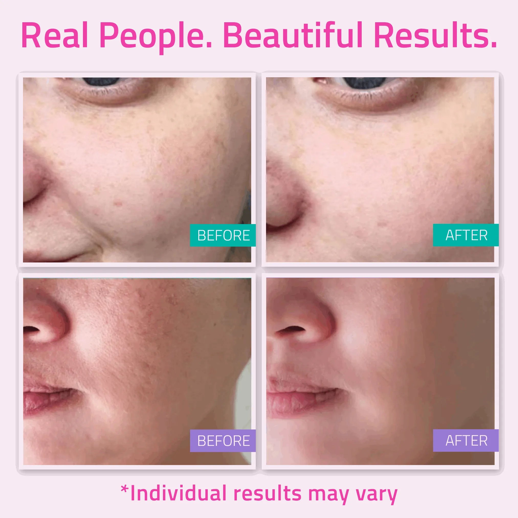 Basic Skincare Essentials Set (5 Pack) Basic Skincare Essentials Set (5 Pack) Basic Skincare Essentials Set (5 Pack)