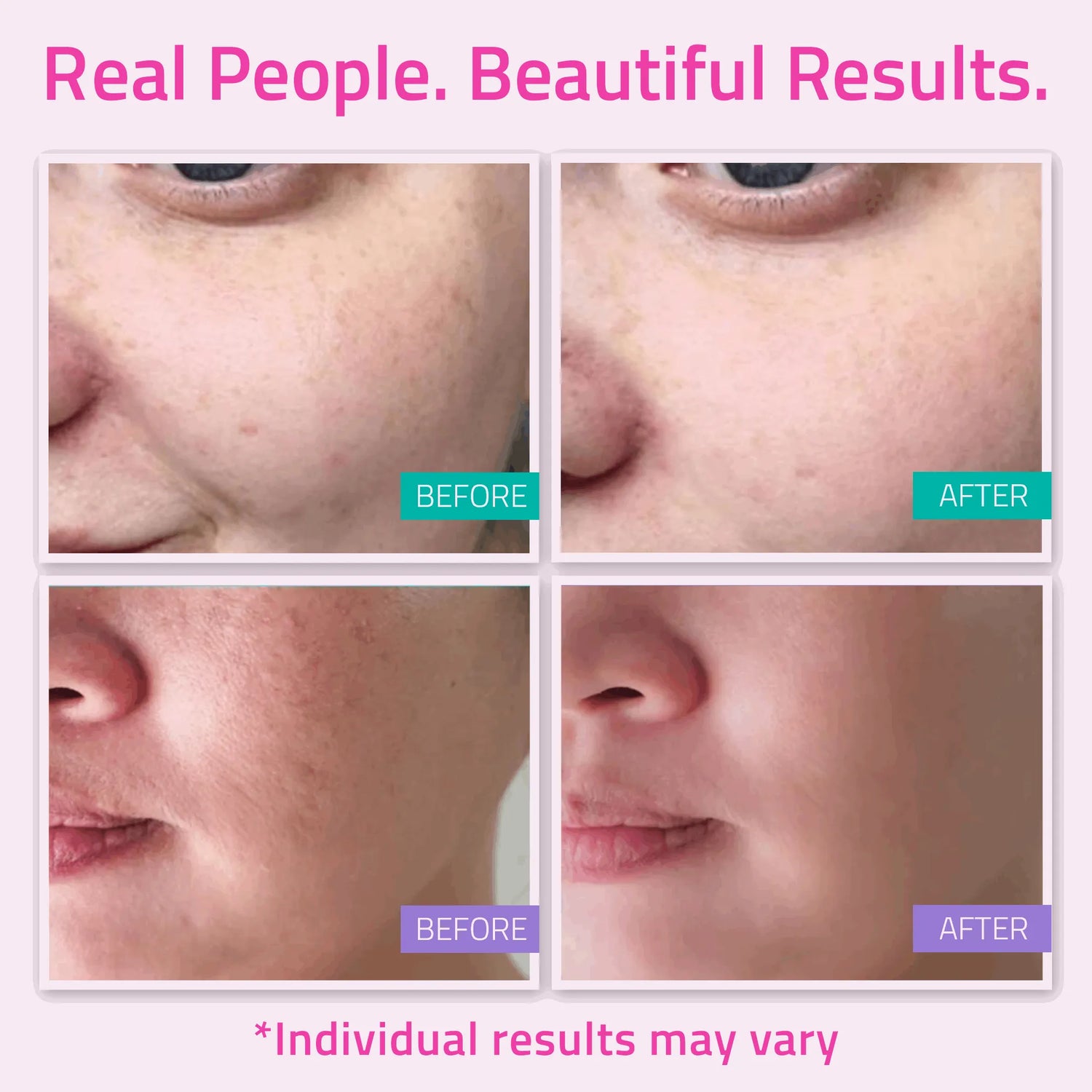 Basic Skincare Essentials Set (5 Pack) Basic Skincare Essentials Set (5 Pack) Basic Skincare Essentials Set (5 Pack)