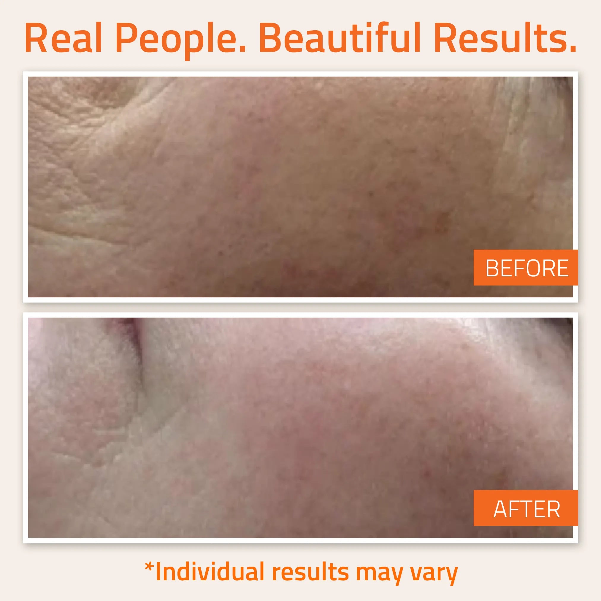 Vitamin C &amp; E Serum Vitamin C &amp; E Serum